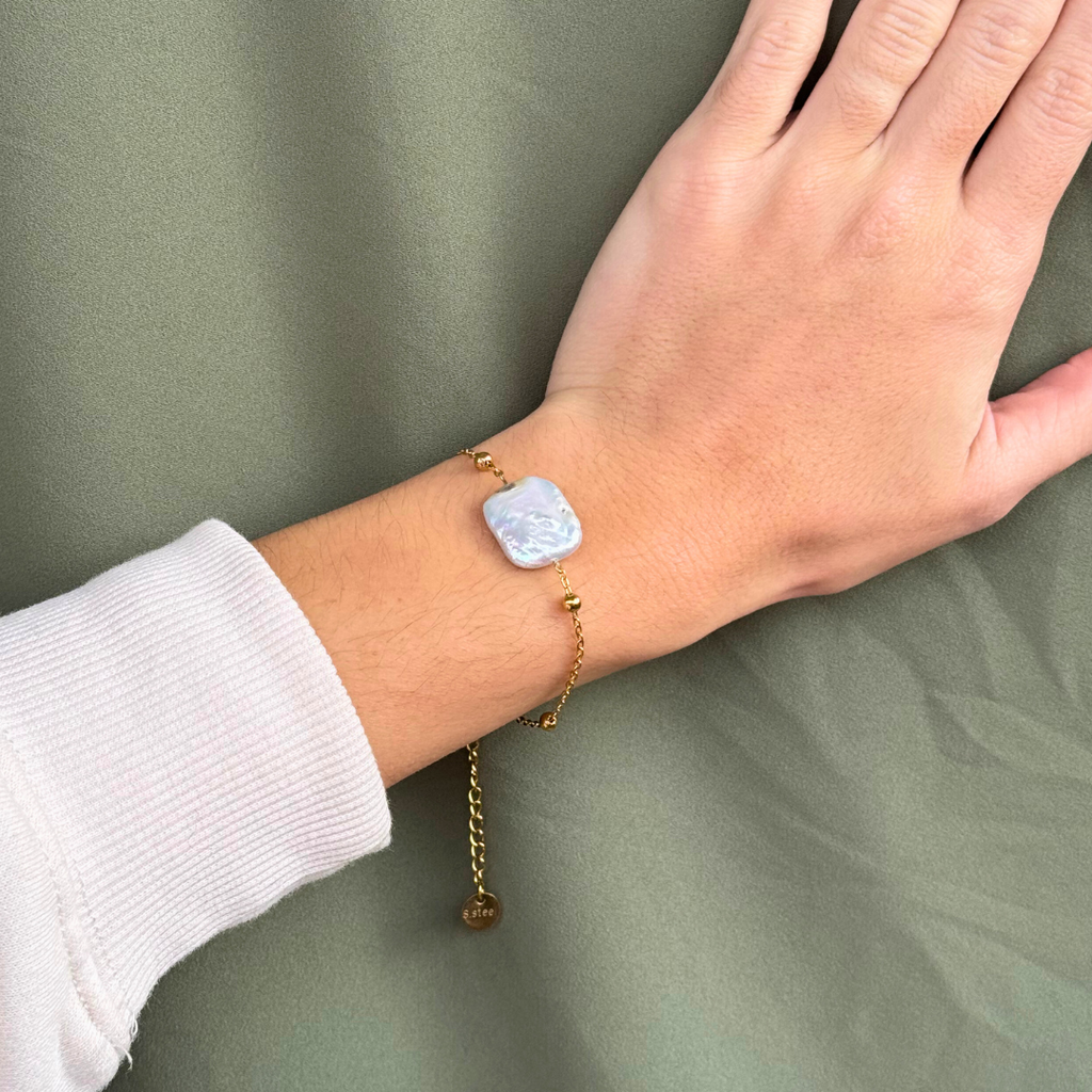 Το βραχιόλι Νταϊάνα