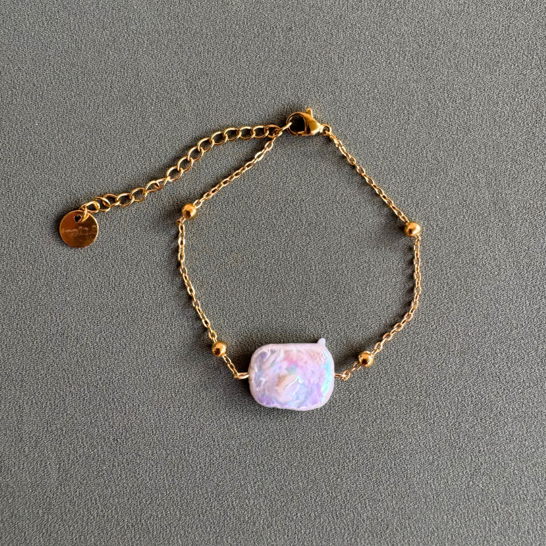 Το βραχιόλι Νταϊάνα