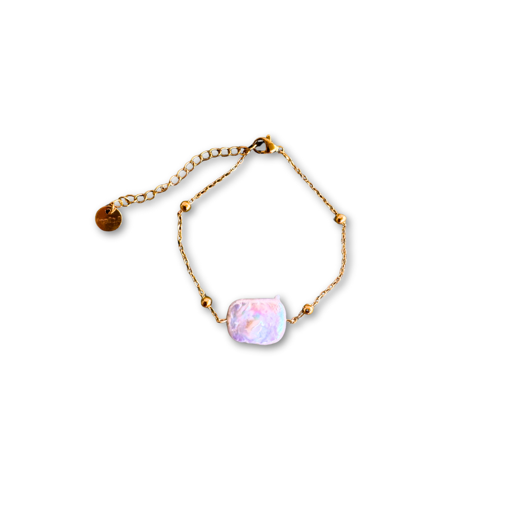 Το βραχιόλι Νταϊάνα